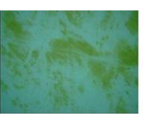 algae inyopools